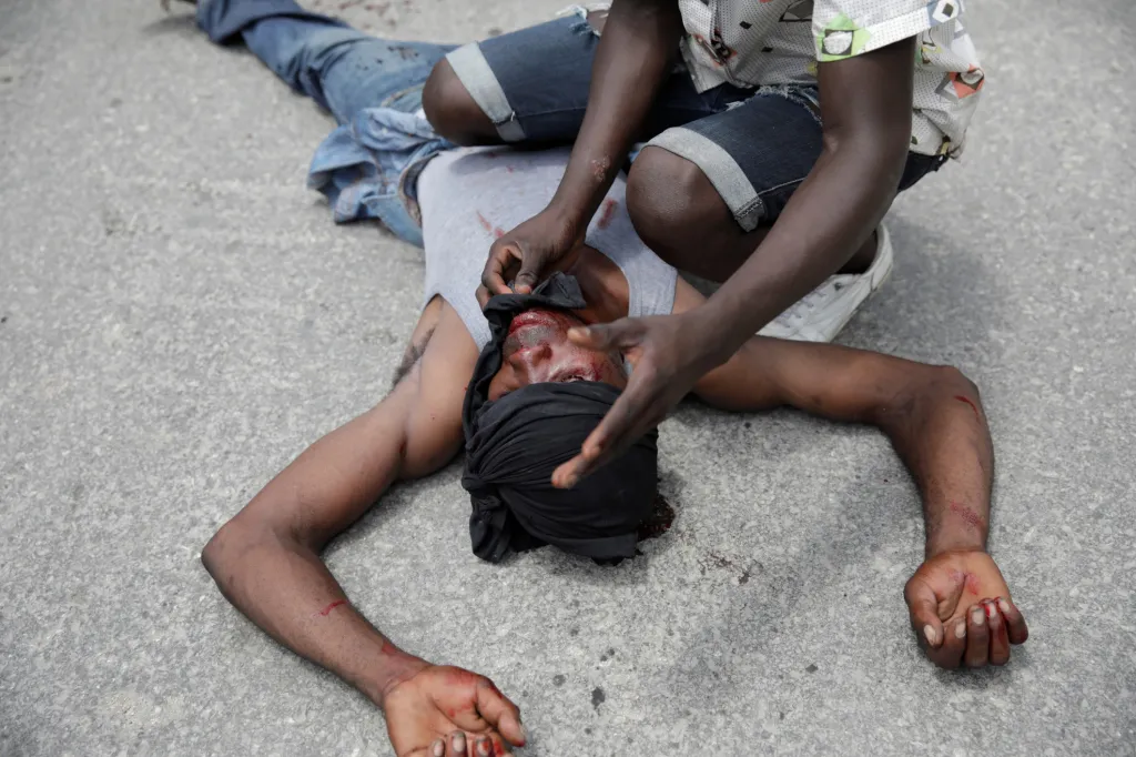 V posledních dnech na Haiti eskalují protesty proti vládě prezidenta Jovenela Moiseho. Během policejních zákroků často dochází ke krvavým střetům. Na fotografii je ošetřován demonstrant po zásahu do hlavy