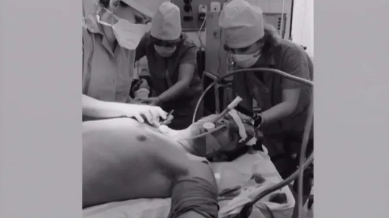 První transplantace jater v Brně (1983)