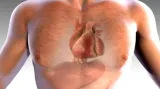 Kampaň: Rychlá reakce může u infarktu zachránit život