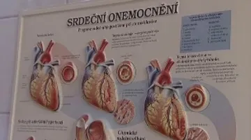 Srdeční onemocnění