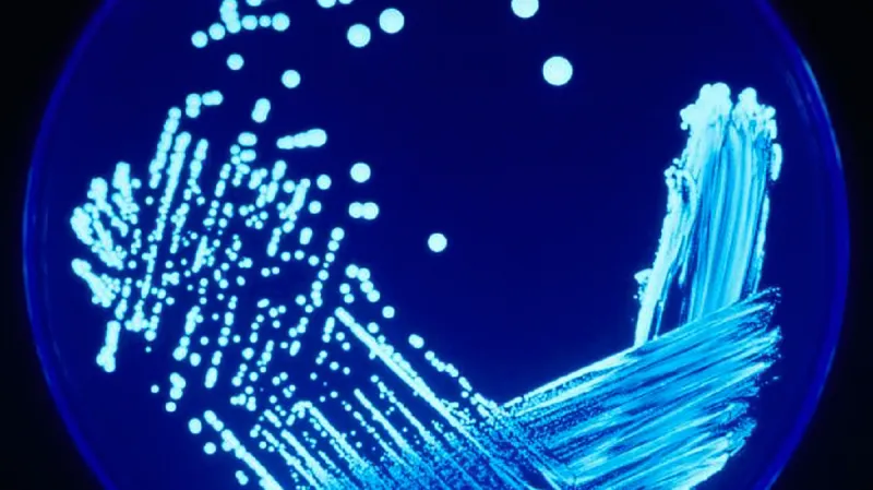 Kultura bakterie legionelly