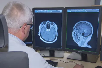 Inovativní léčbu těžkých nádorů mozku by mohla začít platit pojišťovna