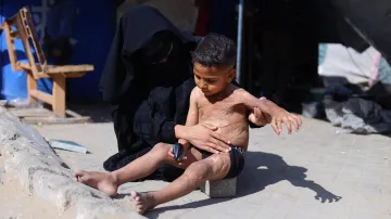 Šestiletý palestinských chlapec popálený během izraelských útoků na Gazu