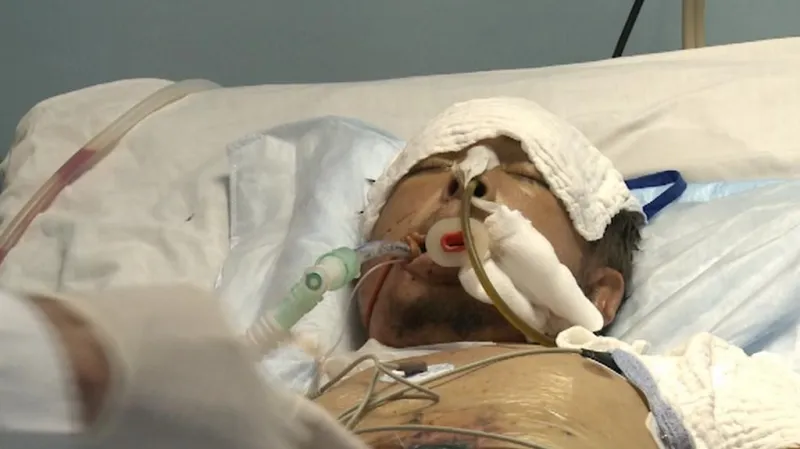 Těžce zranění Syřan Rami