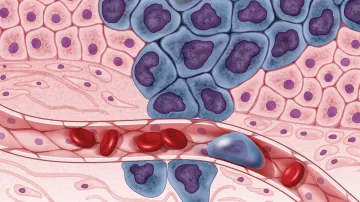 Ilustrační foto – rakovinné buňky