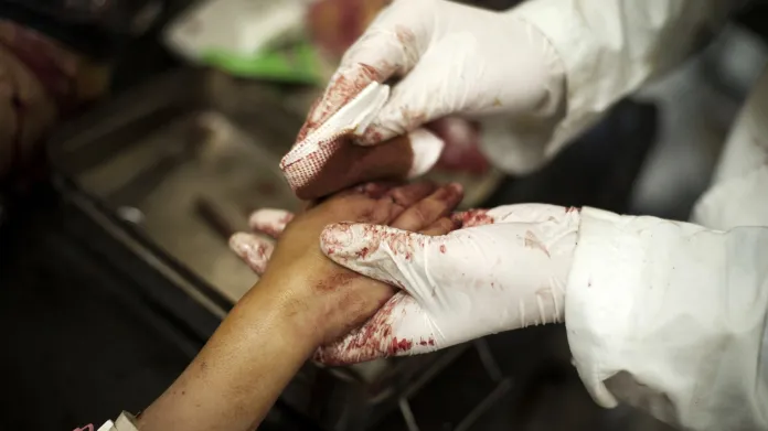 Dívka zraněná při ostřelování nemocnice v syrském Aleppu