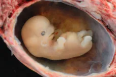 USA přestanou financovat vládní výzkum na lidských embryích