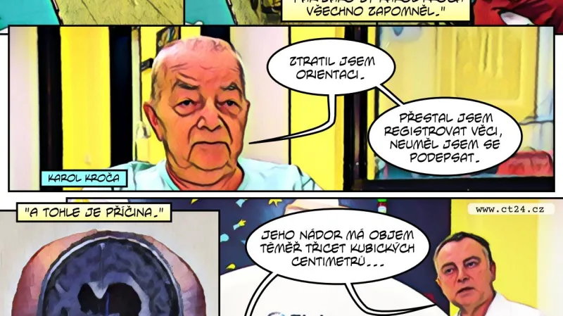 Nemocnice Na Homolce má nový gama nůž. Pomáhá s léčbou nádorů