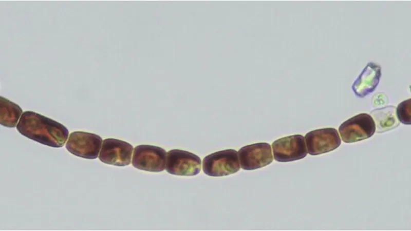 Černá řasa pod mikroskopem