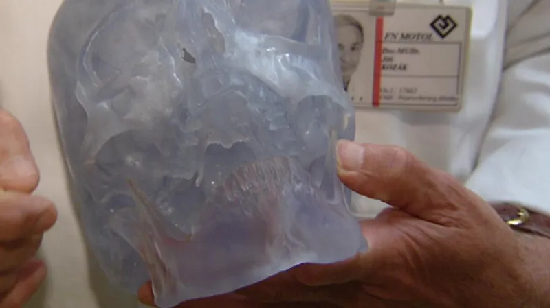 Model lebky pro předoperační přípravu