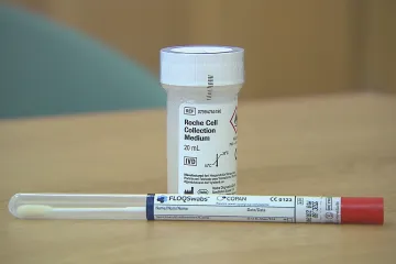 Do prevence rakoviny děložního hrdla se zapojují i praktikové, ženy si v ambulanci mohou nově udělat samotest