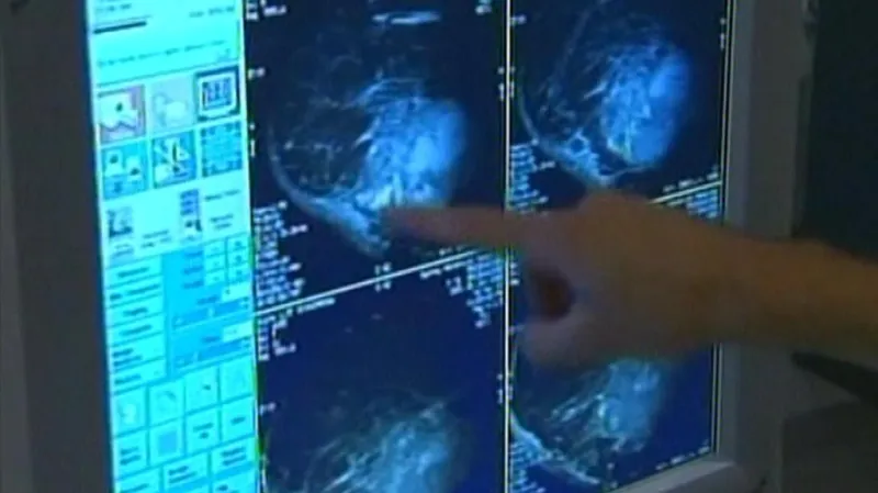 Z Nemocnice Na Františku