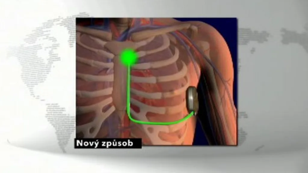 Operace nového defibrilátoru