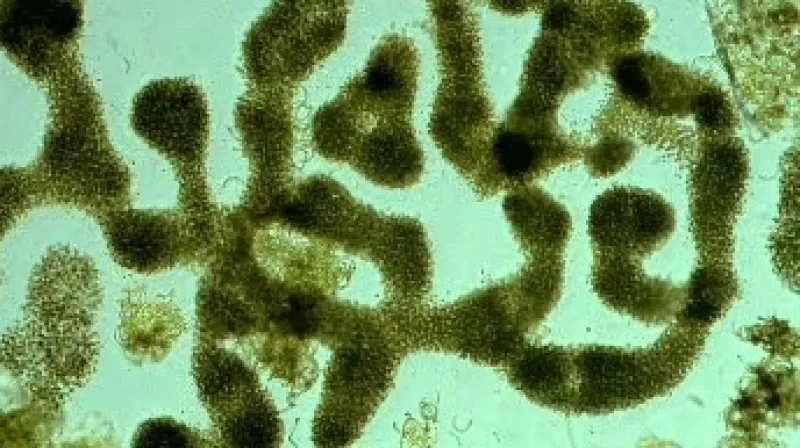 Sinice pod mikroskopem