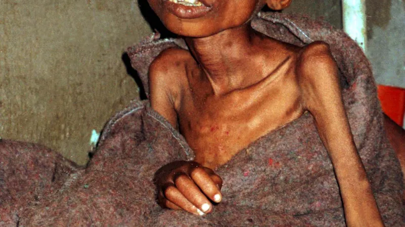 Kvůli válce vypukl v Kongu hladomor, který zasáhl stovky tisíc lidí