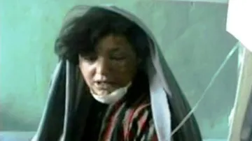 Dívka zraněná při bojích v Afghánistánu