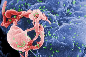 Virus HIV je starší, než jsme mysleli. Čeští vědci ho vystopovali do doby před 60 miliony lety