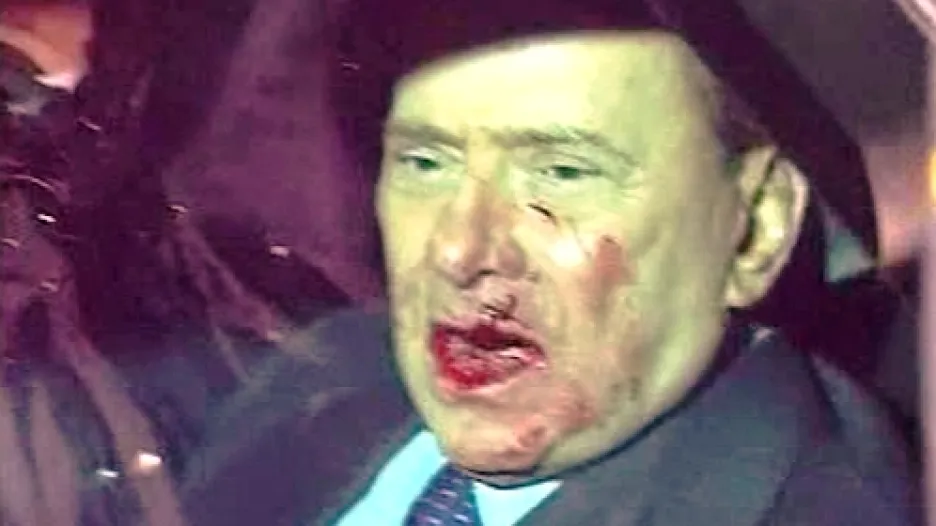 Zraněný Silvio Berlusconi