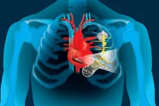 Energie lidského srdce by mohla pohánět elektronické přístroje. Třeba kardiostimulátory
