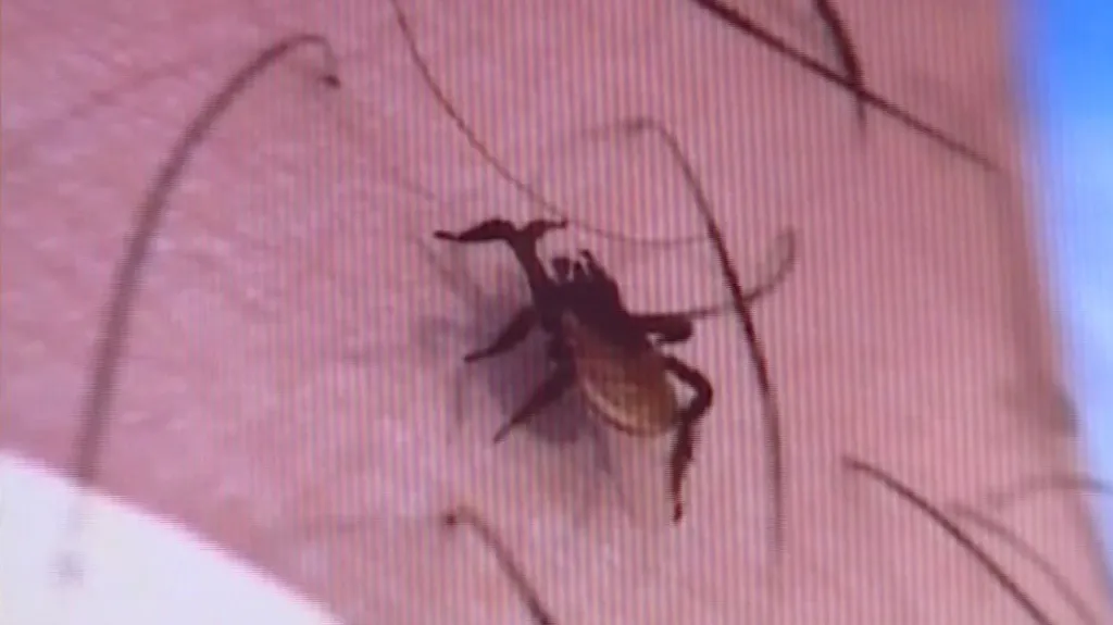 Lidé mohou nechat otestovat jakékoliv klíště