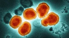 Chřipkový virus pod elektronovým mikroskopem