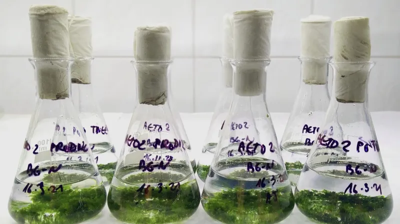 Mikroskopický snímek toxické sinice zodpovědné za otravy ptáků