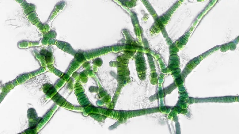 Sinice Aetokthonos hydrillicola