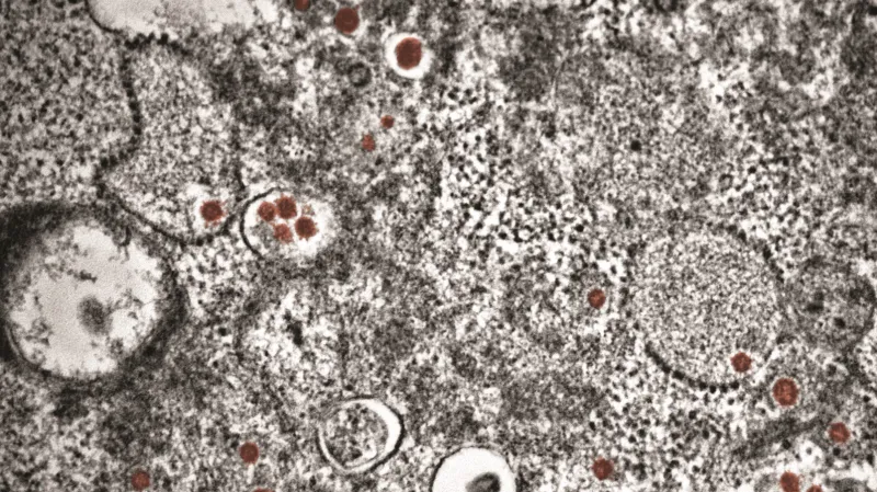 Covid v tkáních, barvený snímek