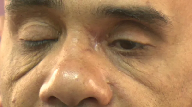 Luaj Abíd se stále dostává ze zásahu policejním projektilem