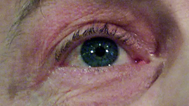 Čína se potýká s virem, který útočí na zrak. Na lidi se přenáší od mořských tvorů