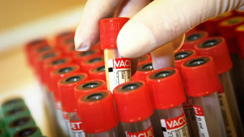 Výsledky mají lidé do tří dnů