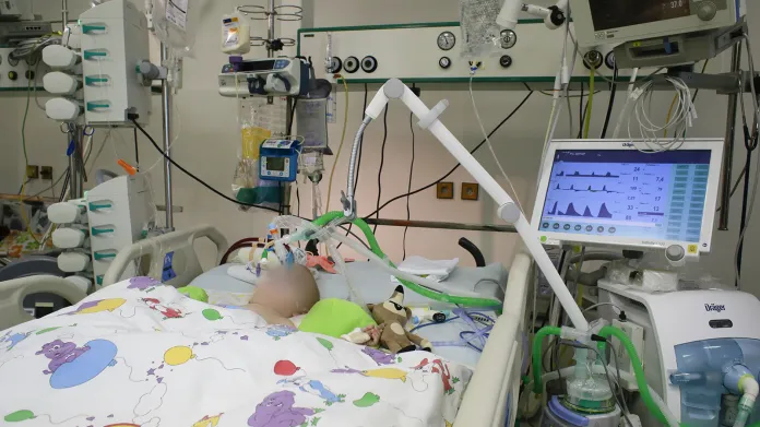 Dětský pacient napojený na mimotělní pumpu na Jednotce intenzivní a resuscitační péče VFN v Praze