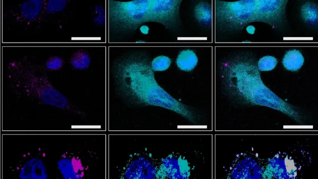 Interakce nanorobotů (modré kuličky) s rakovinovými buňkami. Fialově vyznačené jsou „origami“ peptidy