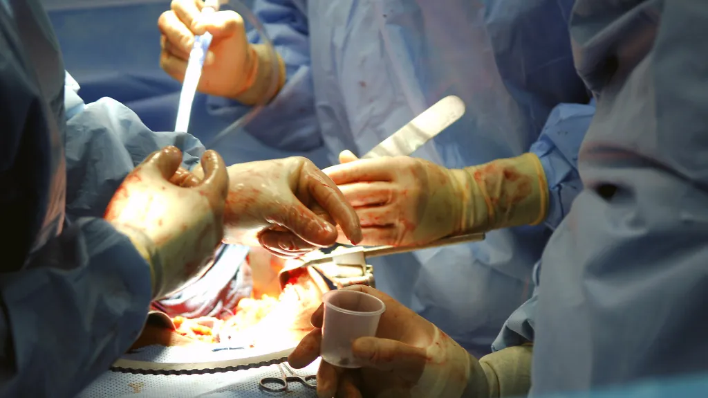 Operace ledvin, ilustrační foto