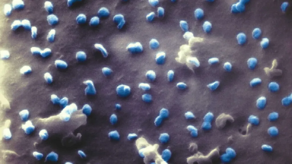 Virus SARS-CoV-2 (modře) pod mikroskopem
