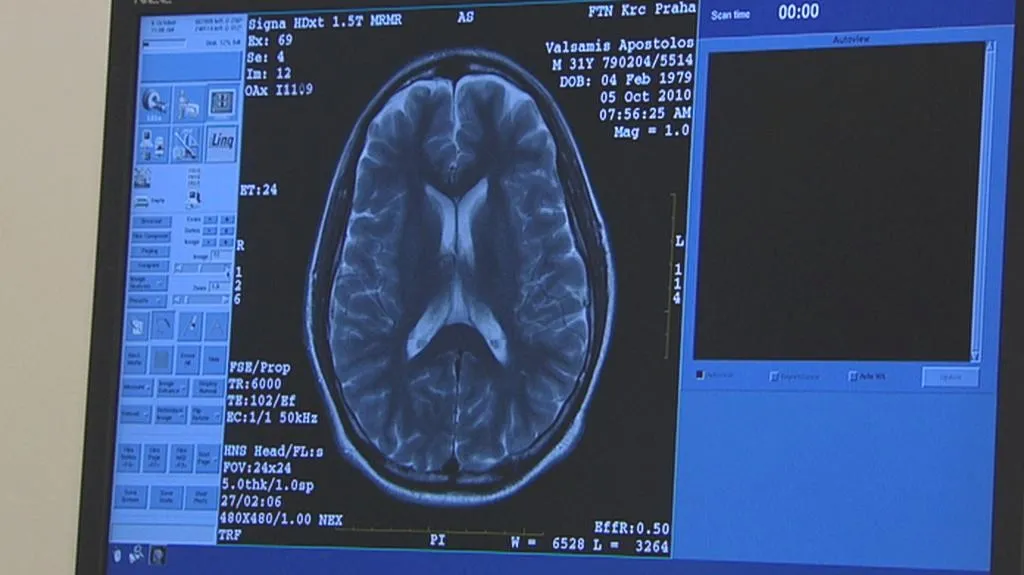 Vyšetření mozku