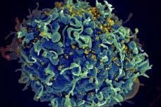 Virus HIV vědci popsali před 40 lety. Díky nim ho lidstvo zkrotilo