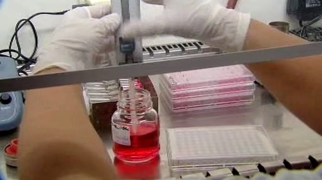 Laboratorní testy