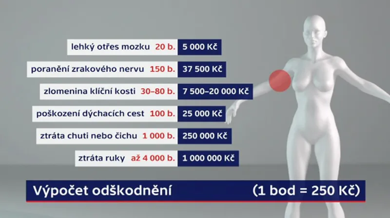 Příklady odškodnění při pracovním úrazu