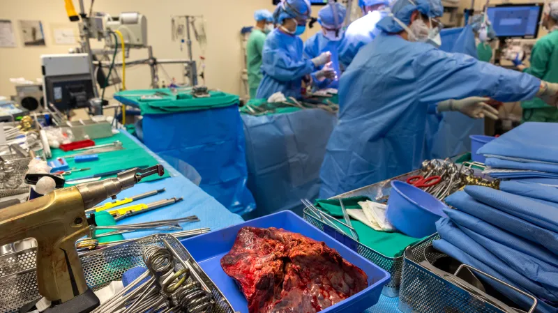 Plíce připravené k transplantaci