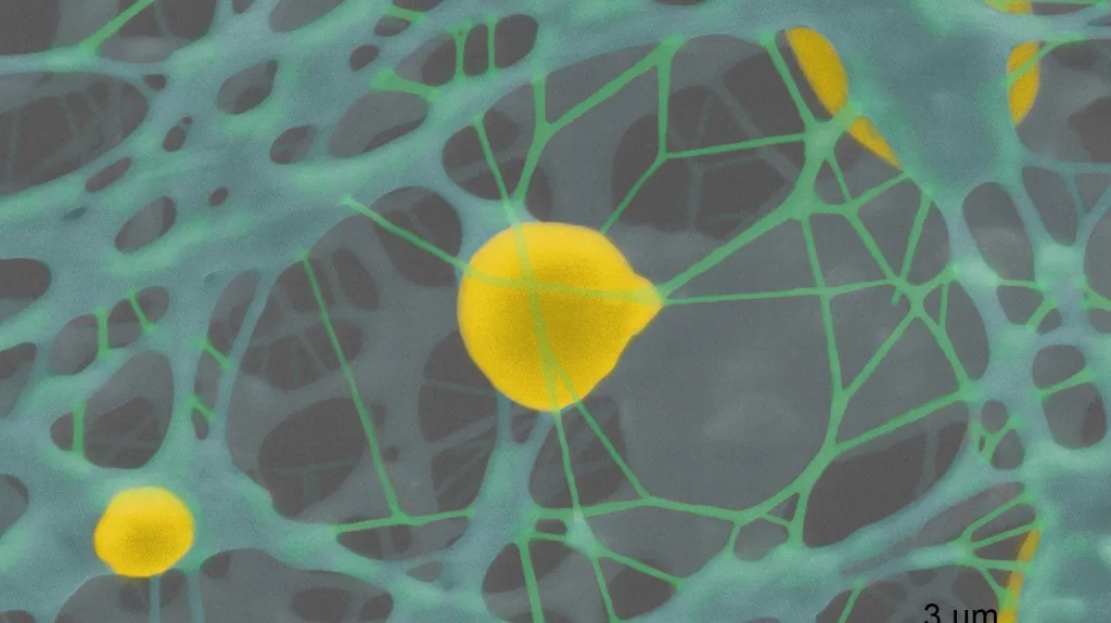 Detail nano-vlákenného biodegradabilního nosiče lidských buněk, určeného pro tkáňové inženýrství (kolorováno). Zobrazeno pomocí nového ionizačního detektoru s elektrostatickým separátorem v podmínkách vysokého tlaku vodních par