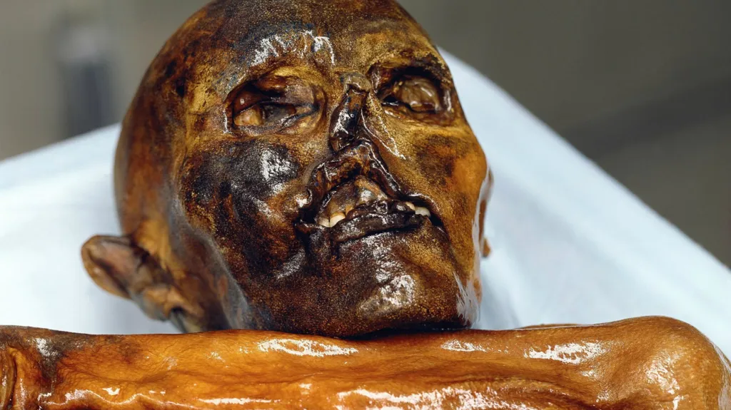Ötzi