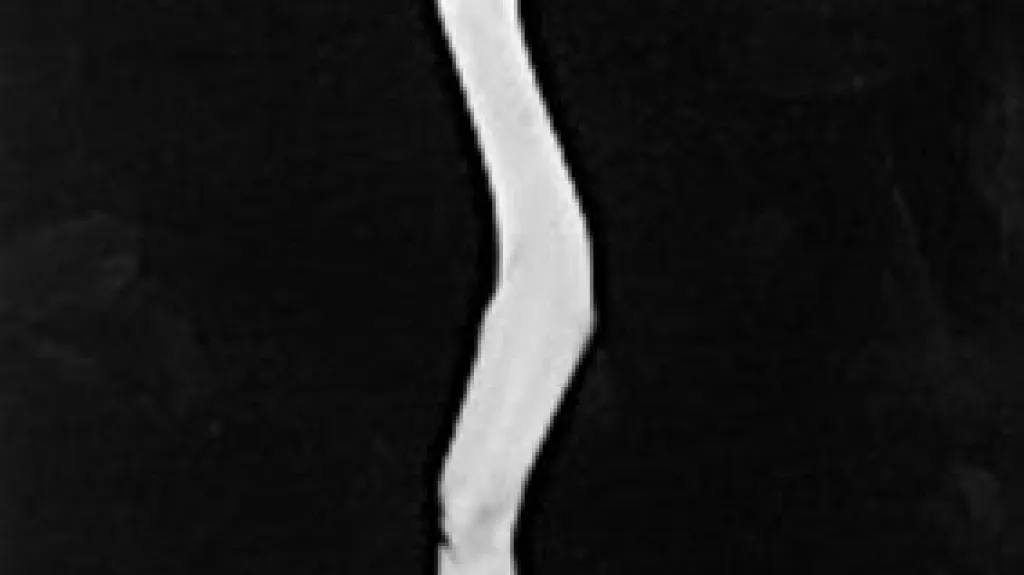 Tono Stano