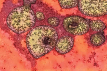 Geny v mitochondriích hrají roli ve vysoké hladině cukru, zjistila česká studie