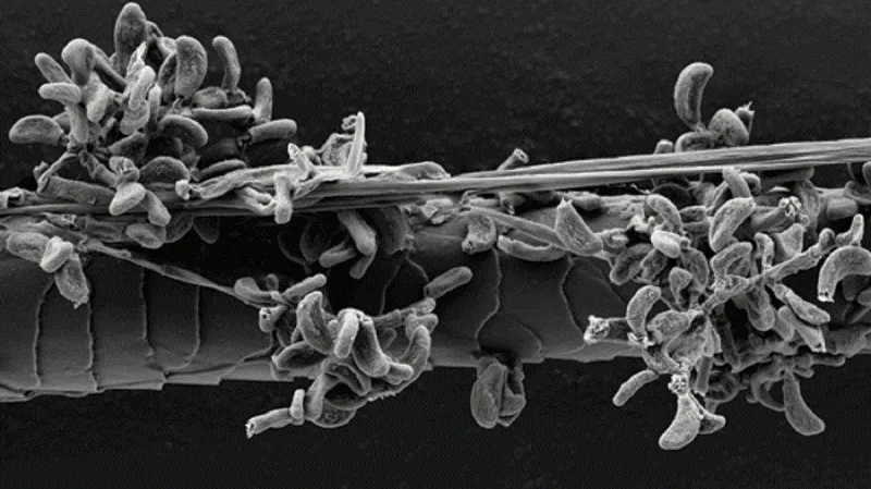 Geomyces destructans