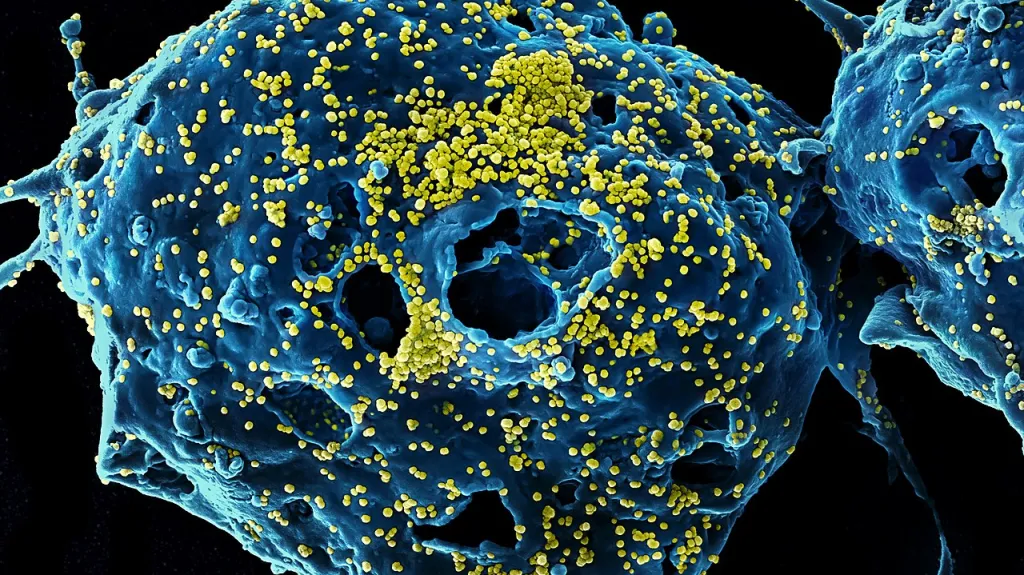 Částice viru MERS-CoV (žlutě) na buňce (modrá)