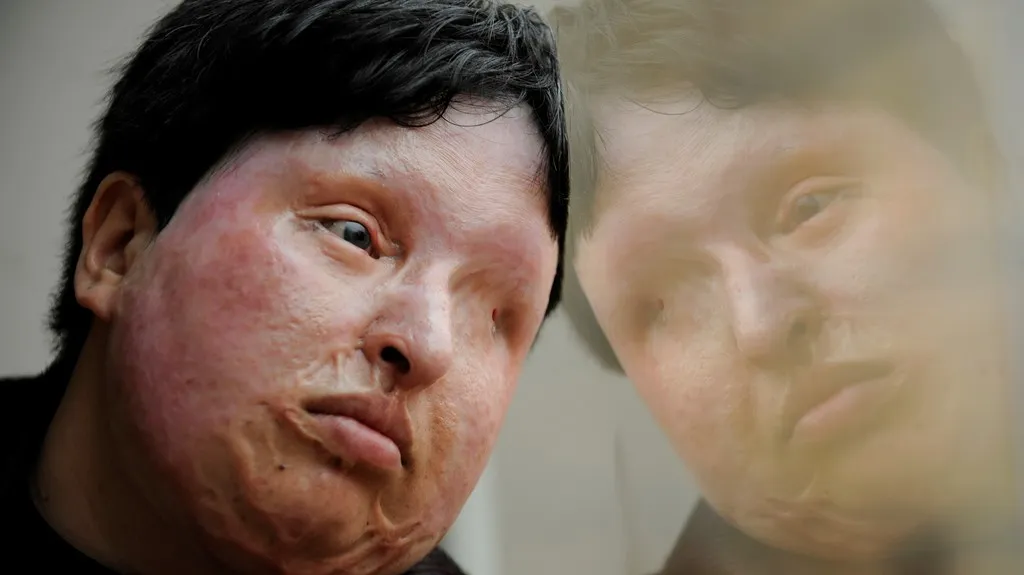 Poleptaná Íránka ušetřila útočníka stejného osudu