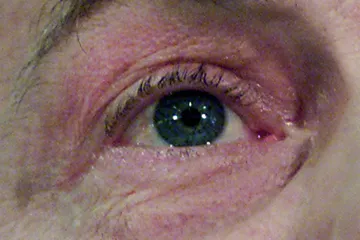 Čína se potýká s virem, který útočí na zrak. Na lidi se přenáší od mořských tvorů