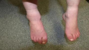 Týraný chlapec musel v botách nosit hřebíky