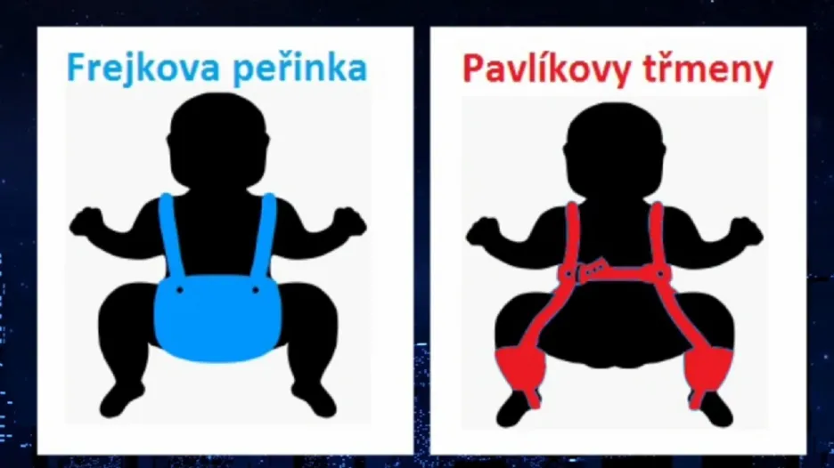 Jak se léčí dysplazie